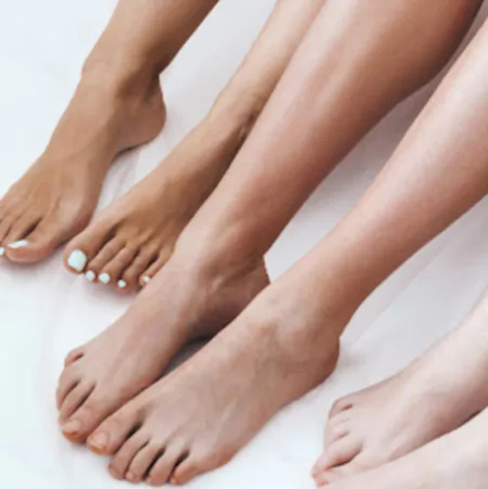 опіки після лазерної епіляції фото