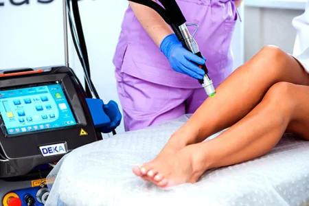 What will happen if I shave after laser hair removal?