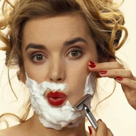 Надмірний ріст волосся. Гіпертрихоз. Гірсутизм.