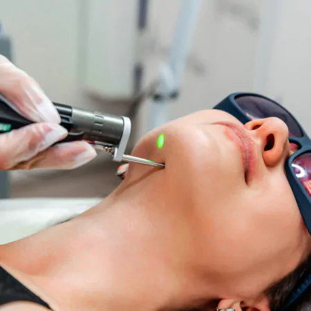 Шкода лазерної епіляції – безглуздий міф чи реальність?