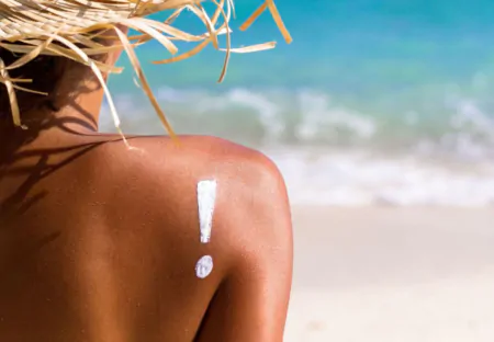 Засмага до і після лазерної епіляції: чому варто зачекати