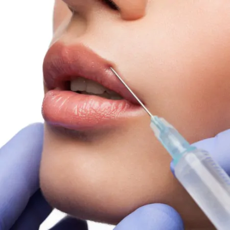 Чи можна робити лазерну епіляцію після ін’єкцій ботоксу чи філерів?