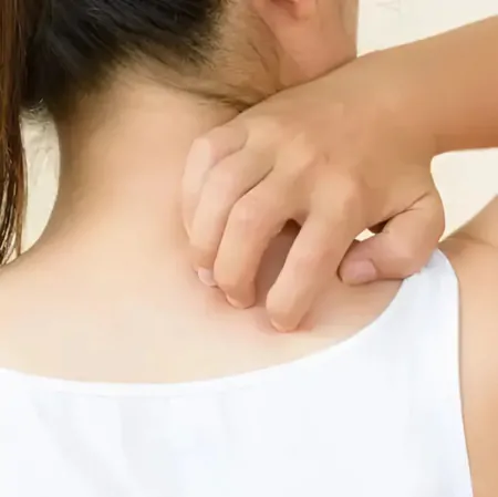 Чи можна робити лазерну епіляцію при псоріазі?